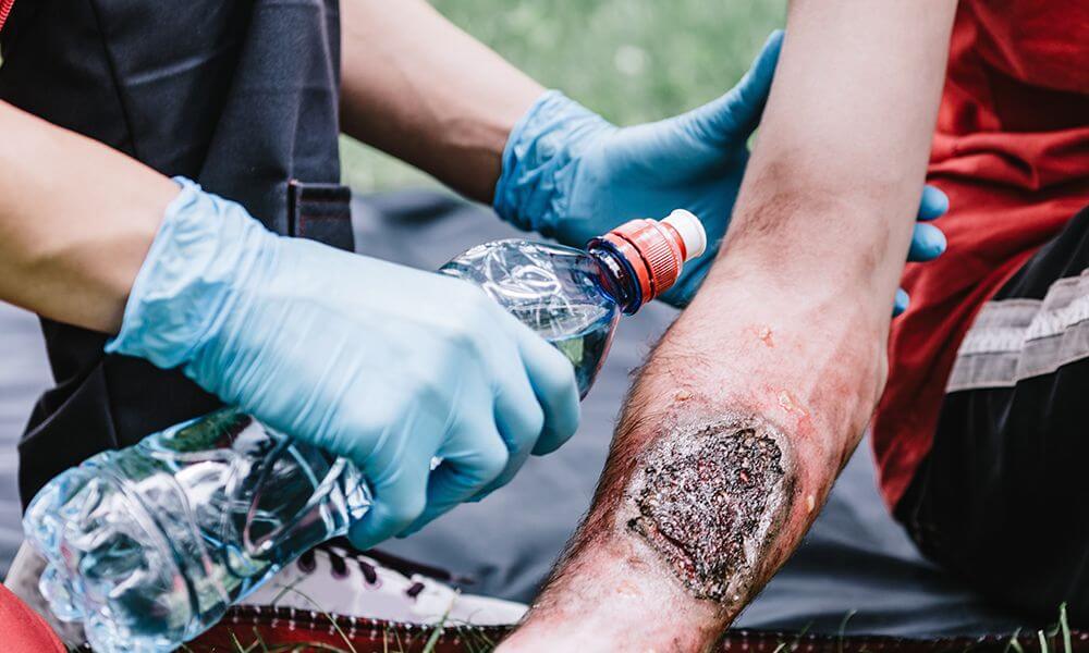 Qu’est-ce que les premiers secours ?