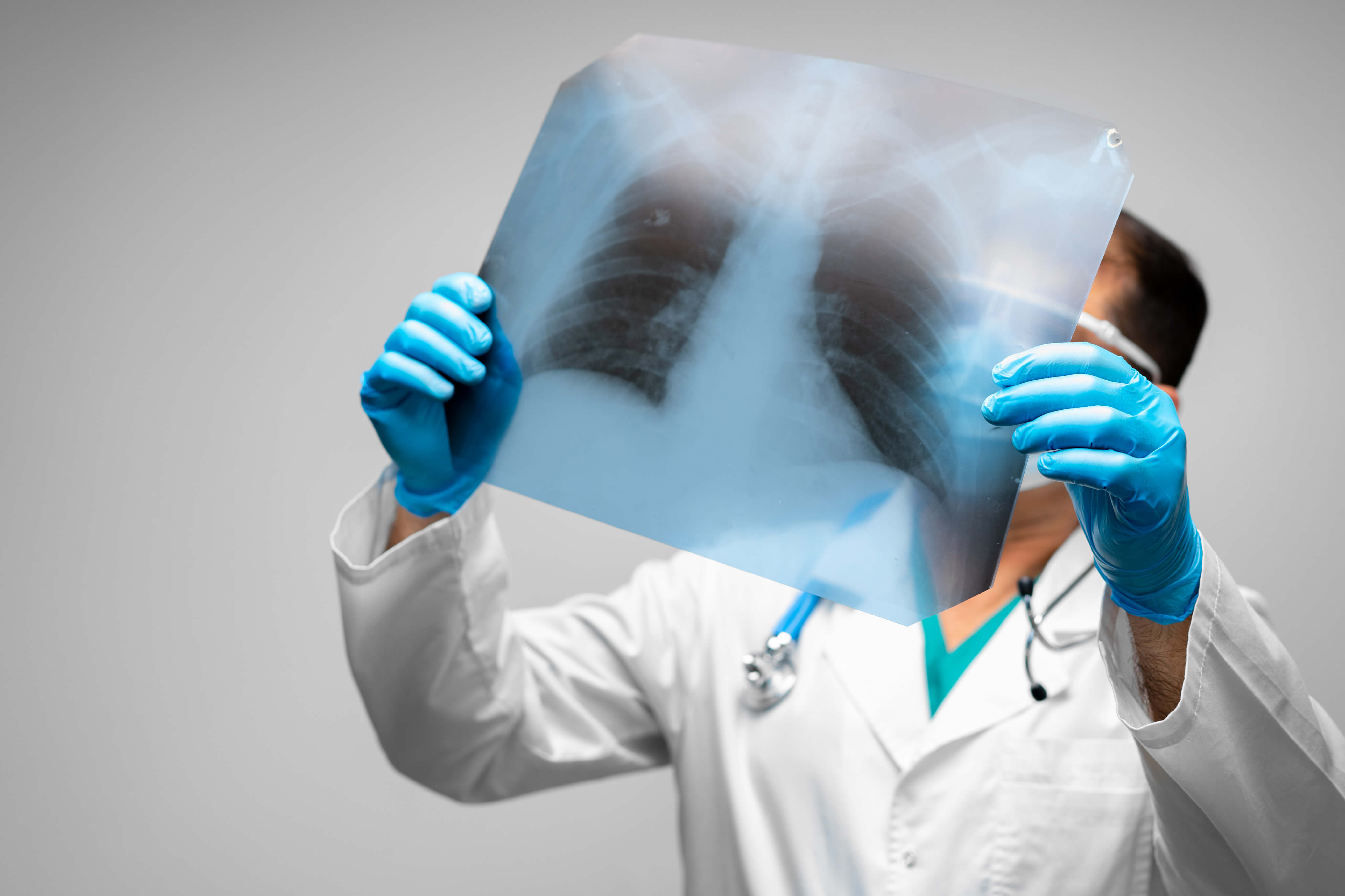 Asthme bronchique