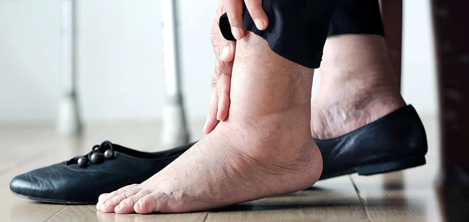 HBOT dans le traitement du pied diabétique