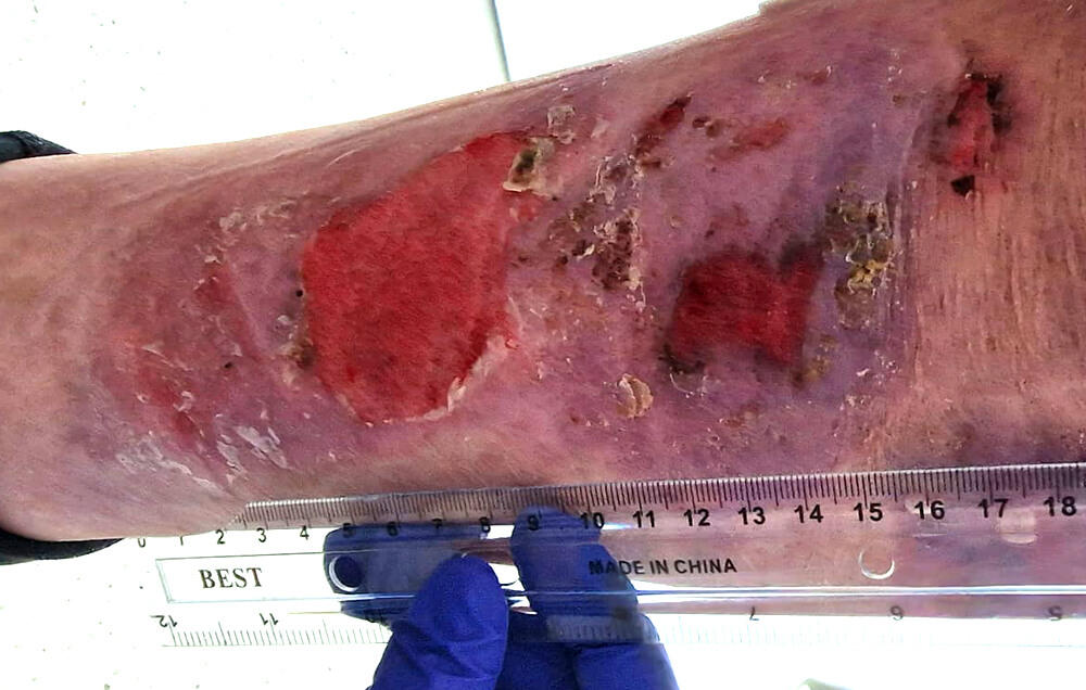 Des blessures qui ne guérissent pas