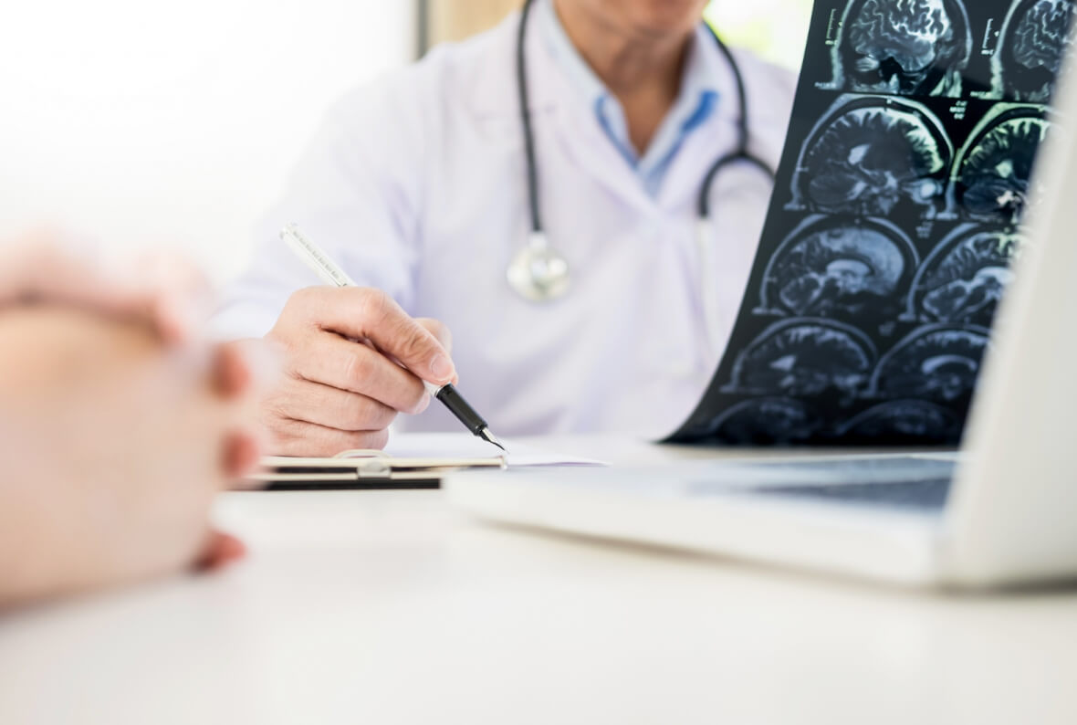 Causes and risk factors of stroke