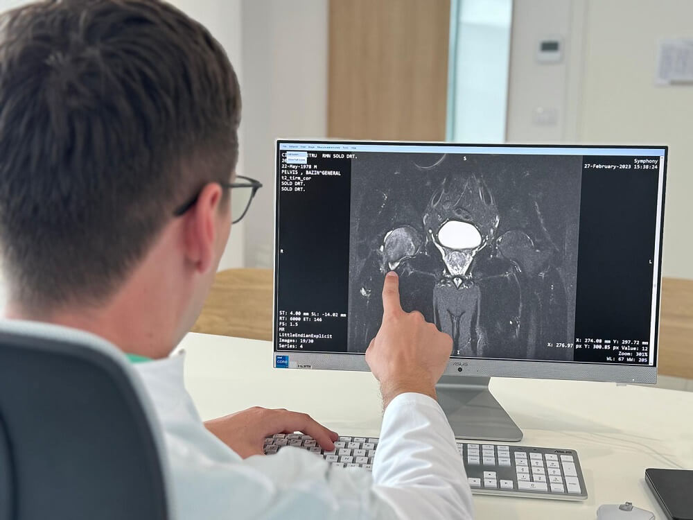 Diagnostic bone necrosis