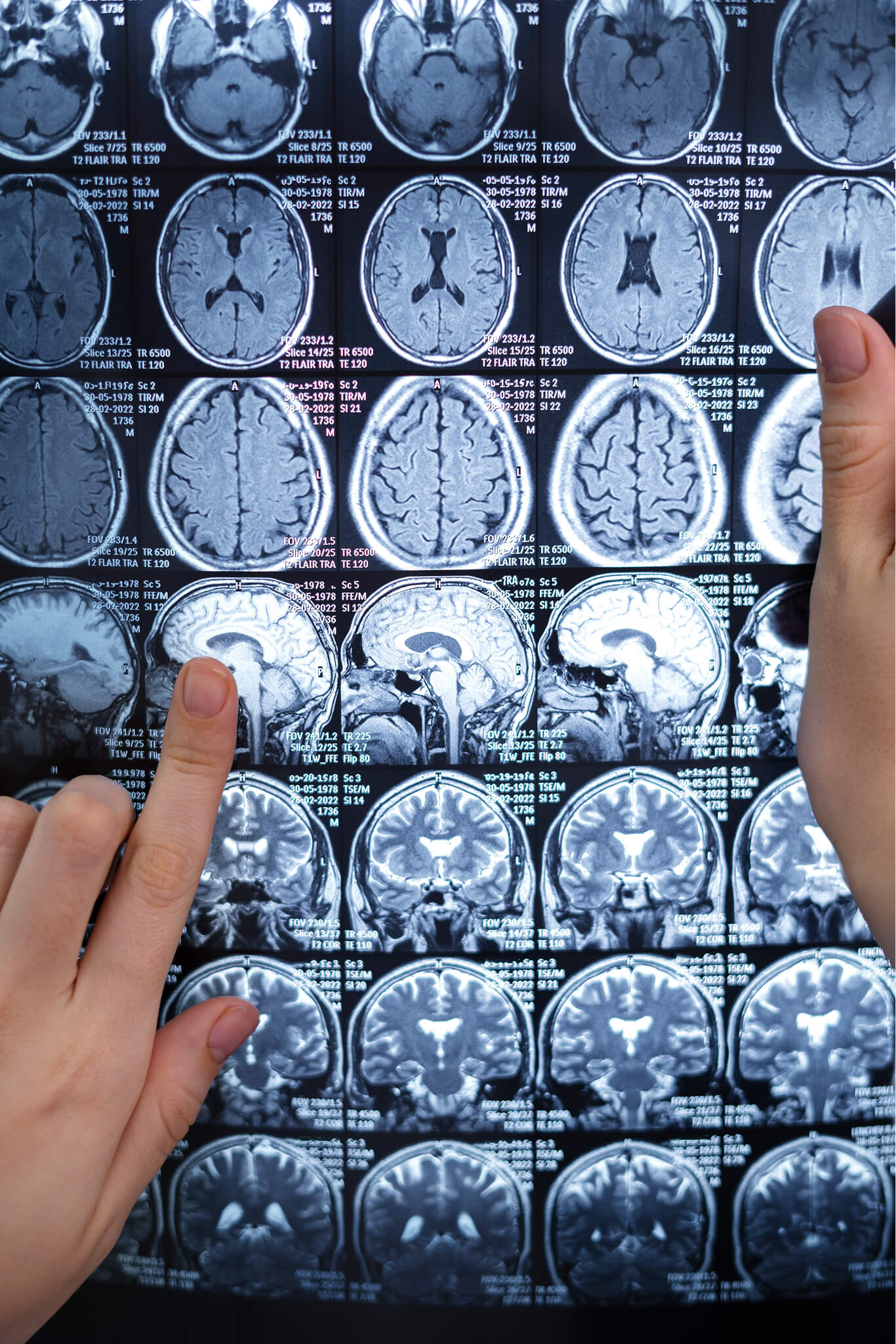 Cognitive and emotional disorders