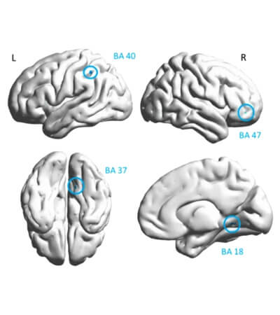 Traumatic brain injury and post-concussive syndrome