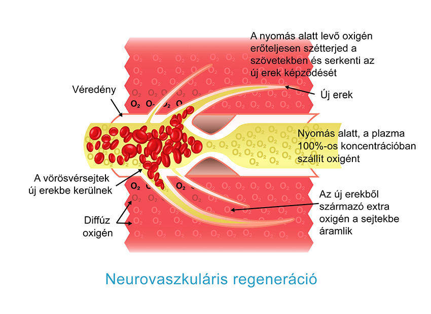 Hiperbár oxigénellátás