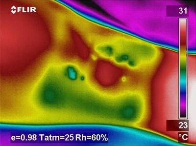 Ustioni, scottature, congelamenti