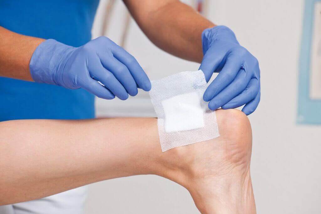 Bendaggio Piede Diabetico