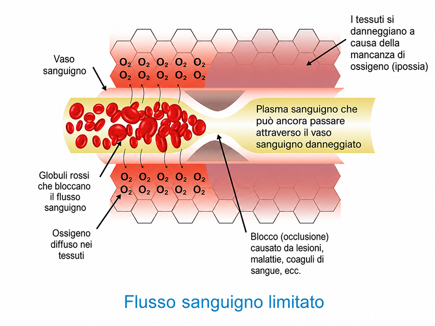 Flusso sanguigno ridotto