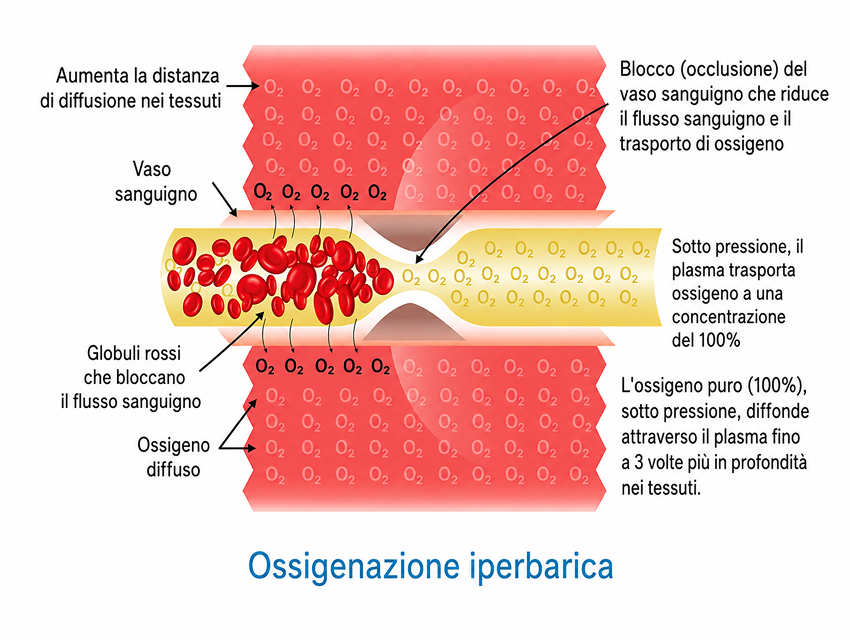Ossigenazione iperbarica